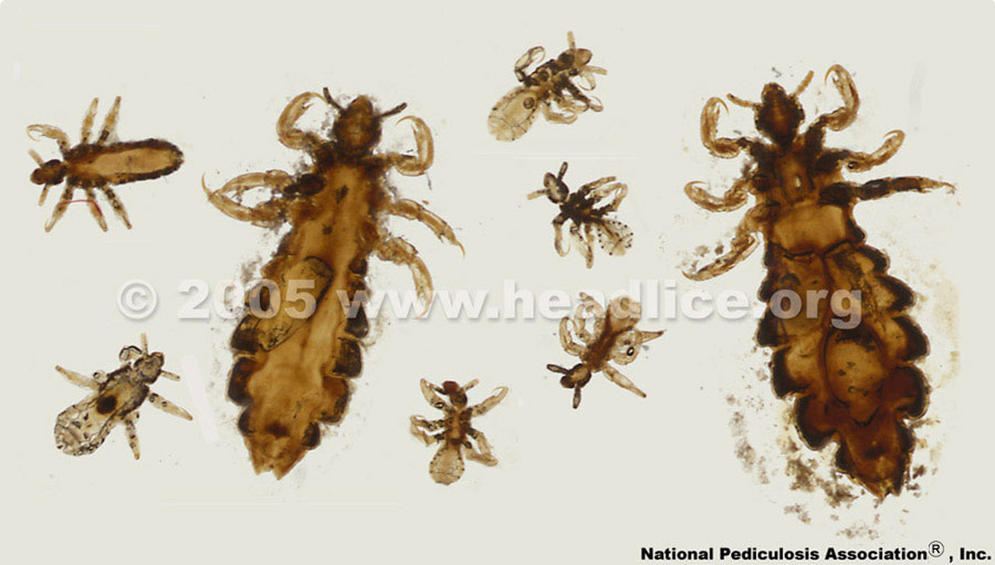 Lousology 101 – Understand louse and nits 